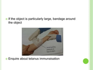  If the object is particularly large, bandage around
the object
 Enquire about tetanus immunaisation
 