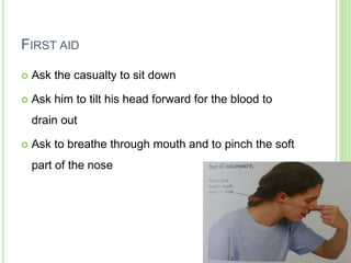FIRST AID
 Ask the casualty to sit down
 Ask him to tilt his head forward for the blood to
drain out
 Ask to breathe through mouth and to pinch the soft
part of the nose
 