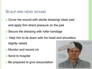 SCALP AND HEAD WOUND
 Cover the wound with sterile dressing/ clean pad
and apply firm direct pressure on the pad
 Secure the dressing with roller bandage
 Help him to lie down with his head and shoulders
slightly raised
 Monitor and record v/s
 Send to hospital
 Be prepared to give resuscitation
 