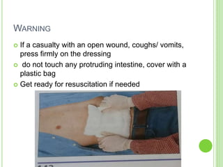 WARNING
 If a casualty with an open wound, coughs/ vomits,
press firmly on the dressing
 do not touch any protruding intestine, cover with a
plastic bag
 Get ready for resuscitation if needed
 