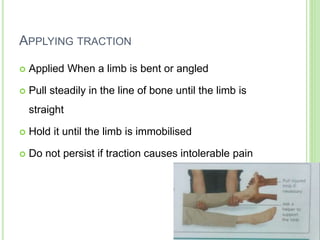 APPLYING TRACTION
 Applied When a limb is bent or angled
 Pull steadily in the line of bone until the limb is
straight
 Hold it until the limb is immobilised
 Do not persist if traction causes intolerable pain
 