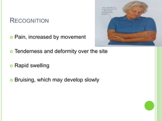 RECOGNITION
 Pain, increased by movement
 Tenderness and deformity over the site
 Rapid swelling
 Bruising, which may develop slowly
 