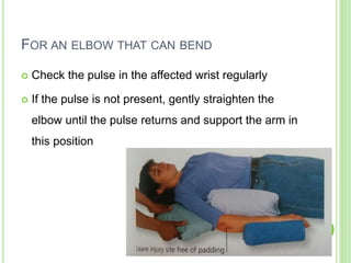 FOR AN ELBOW THAT CAN BEND
 Check the pulse in the affected wrist regularly
 If the pulse is not present, gently straighten the
elbow until the pulse returns and support the arm in
this position
 