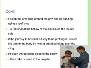 CONT..
 Fasten the arm sling around the arm and its padding
using a reef knot.
 Tie the knot at the hollow of the clavicle on the injured
side
 If the journey to hospital is likely to be prolonged, secure
the arm to the body by tying a broad bandage over the
sling.
 Position the bandage close to the elbow
 . Then take or send to the hospital
 