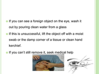  If you can see a foreign object on the eye, wash it
out by pouring clean water from a glass
 If this is unsuccessful, lift the object off with a moist
swab or the damp corner of a tissue or clean hand
kerchief.
 If you can’t still remove it, seek medical help
 