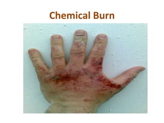 First aid powerpoint | PPTX