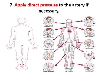 7. Apply direct pressure to the artery if
necessary.
 
