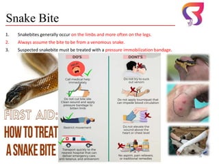 Snake Bite
1. Snakebites generally occur on the limbs and more often on the legs.
2. Always assume the bite to be from a venomous snake.
3. Suspected snakebite must be treated with a pressure immobilization bandage.
Dr. Sushma Kaushal 18
 