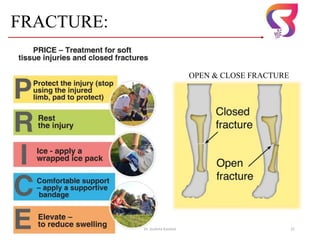 FRACTURE:
Dr. Sushma Kaushal 21
OPEN & CLOSE FRACTURE
 