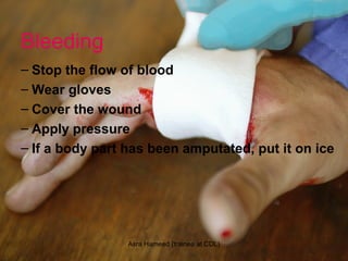 Bleeding
– Stop the flow of blood
– Wear gloves
– Cover the wound
– Apply pressure
– If a body part has been amputated, put it on ice
Asra Hameed (trainee at CDL)
 