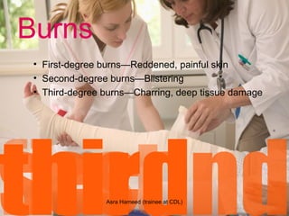 Burns
• First-degree burns—Reddened, painful skin
• Second-degree burns—Blistering
• Third-degree burns—Charring, deep tissue damage
Asra Hameed (trainee at CDL)
 