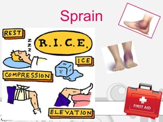 Sprain
 