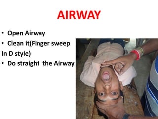 First Aid PPT PDF.pdf