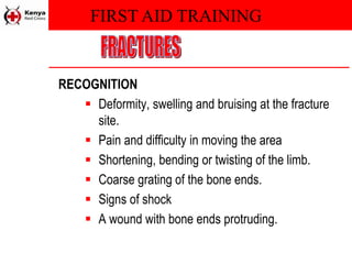 FIRST AID TRAINING
RECOGNITION
 Deformity, swelling and bruising at the fracture
site.
 Pain and difficulty in moving the area
 Shortening, bending or twisting of the limb.
 Coarse grating of the bone ends.
 Signs of shock
 A wound with bone ends protruding.
 