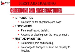 FIRST AID TRAINING
 INTRODUCTION
 Fractures on the cheekbone and nose
 RECOGNITION
 Pain, swelling and bruising
 A wound or bleeding from the nose or mouth.
 FIRST AID PRIORITIES
 To minimize pain and swelling.
 To arrange to transport or send the casualty to
hospital.
 