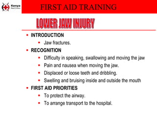 FIRST AID TRAINING
 INTRODUCTION
 Jaw fractures.
 RECOGNITION
 Difficulty in speaking, swallowing and moving the jaw
 Pain and nausea when moving the jaw.
 Displaced or loose teeth and dribbling.
 Swelling and bruising inside and outside the mouth
 FIRST AID PRIORITIES
 To protect the airway.
 To arrange transport to the hospital.
 