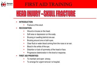 FIRST AID TRAINING
 INTRODUCTION
 Fracture of the skull.
 RECOGNITION
 Wound or bruise on the head.
 Soft area or depression on the scalp.
 Bruising or swelling behind one ear.
 Bruising around one or both eyes.
 Clear fluid or water blood coming from the nose or an ear.
 Blood in the white of the eye.
 Distortion or lack of symmetry of the head or face.
 Progressive deterioration in the level or response.
 FIRST AID PRIORITIES
 To maintain and open airway.
 To arrange for urgent removal to hospital.
 