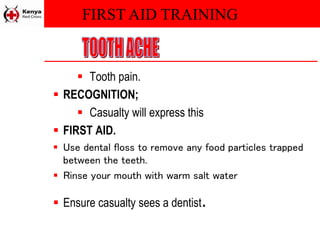 FIRST AID TRAINING
 Tooth pain.
 RECOGNITION;
 Casualty will express this
 FIRST AID.
 Use dental floss to remove any food particles trapped
between the teeth.
 Rinse your mouth with warm salt water
 Ensure casualty sees a dentist.
 