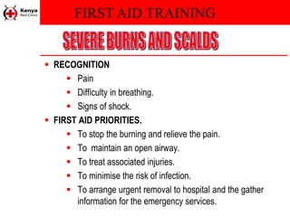 FIRST AID TRAINING
 RECOGNITION
 Pain
 Difficulty in breathing.
 Signs of shock.
 FIRST AID PRIORITIES.
 To stop the burning and relieve the pain.
 To maintain an open airway.
 To treat associated injuries.
 To minimise the risk of infection.
 To arrange urgent removal to hospital and the gather
information for the emergency services.
 