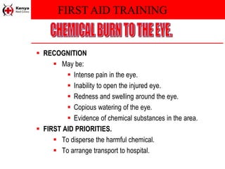 FIRST AID TRAINING
 RECOGNITION
 May be:
 Intense pain in the eye.
 Inability to open the injured eye.
 Redness and swelling around the eye.
 Copious watering of the eye.
 Evidence of chemical substances in the area.
 FIRST AID PRIORITIES.
 To disperse the harmful chemical.
 To arrange transport to hospital.
 