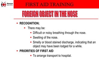 FIRST AID TRAINING
 RECOGNITION;
 There may be:
 Difficult or noisy breathing through the nose.
 Swelling of the nose.
 Smelly or blood stained discharge, indicating that an
object may have been lodged for a while.
 PRIORITIES OF FIRST AID
 To arrange transport to hospital.
 