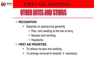 FIRST AID TRAINING
 RECOGNITION
 Depends on species but generally
 Pain, and swelling at the site of sting
 Nausea and vomiting.
 Headache.
 FIRST AID PRIORITIES.
 To relieve he pain and swelling.
 To arrange removal to hospital, if necessary.
 