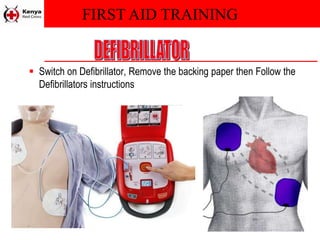 FIRST AID TRAINING
 Switch on Defibrillator, Remove the backing paper then Follow the
Defibrillators instructions
 