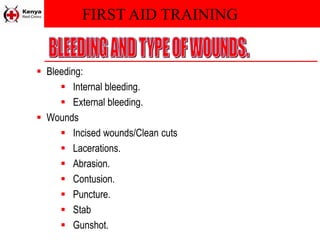 FIRST AID TRAINING
 Bleeding:
 Internal bleeding.
 External bleeding.
 Wounds
 Incised wounds/Clean cuts
 Lacerations.
 Abrasion.
 Contusion.
 Puncture.
 Stab
 Gunshot.
 