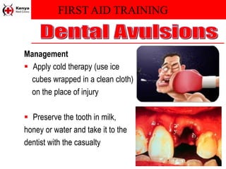 FIRST AID TRAINING
Management
 Apply cold therapy (use ice
cubes wrapped in a clean cloth)
on the place of injury
 Preserve the tooth in milk,
honey or water and take it to the
dentist with the casualty
 