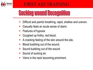 FIRST AID TRAINING
 Difficult and painful breathing, rapid, shallow and uneven.
 Casualty feels an acute sense of alarm.
 Features of hypoxia
 Coughed up frothy, red blood.
 A cracking feeling of the skin around the site.
 Blood bubbling out of the wound.
 Sound bubbling out of the wound
 Sound of sucking air.
 Veins in the neck becoming prominent.
 