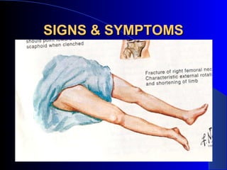 SIGNS & SYMPTOMS
 