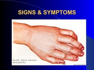 SIGNS & SYMPTOMS
 