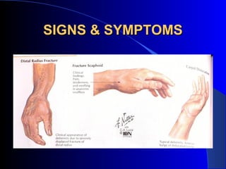SIGNS & SYMPTOMS
 
