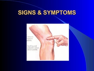 SIGNS & SYMPTOMS
 