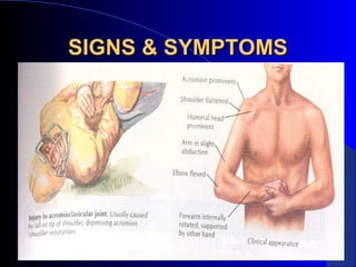 SIGNS & SYMPTOMS
 