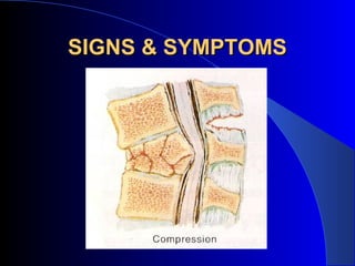 SIGNS & SYMPTOMS
 