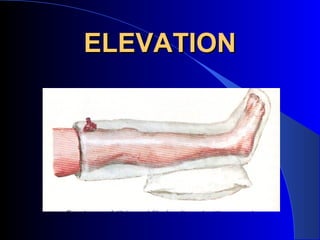 ELEVATION
 