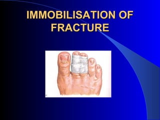 IMMOBILISATION OF
   FRACTURE
 
