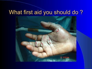 What first aid you should do ?
 