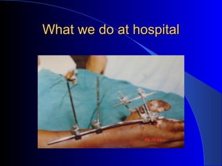 What we do at hospital
 