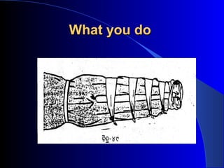 What you do
 