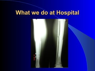 What we do at Hospital
 