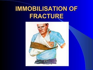 IMMOBILISATION OF
   FRACTURE
 