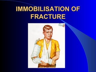 IMMOBILISATION OF
   FRACTURE
 