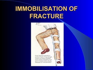 IMMOBILISATION OF
   FRACTURE
 