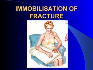 IMMOBILISATION OF
   FRACTURE
 