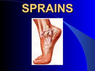 SPRAINS
 