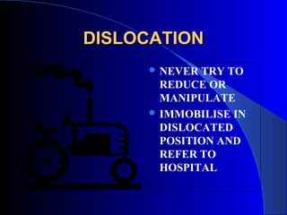 DISLOCATION
      NEVER TRY TO
       REDUCE OR
       MANIPULATE
      IMMOBILISE IN
       DISLOCATED
       POSITION AND
       REFER TO
       HOSPITAL
 