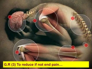 G.R (3) To reduce if not end pain…
 