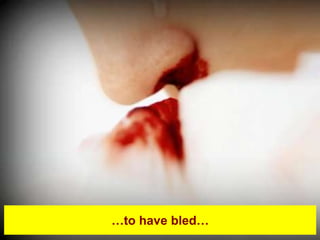 …to have bled…
 